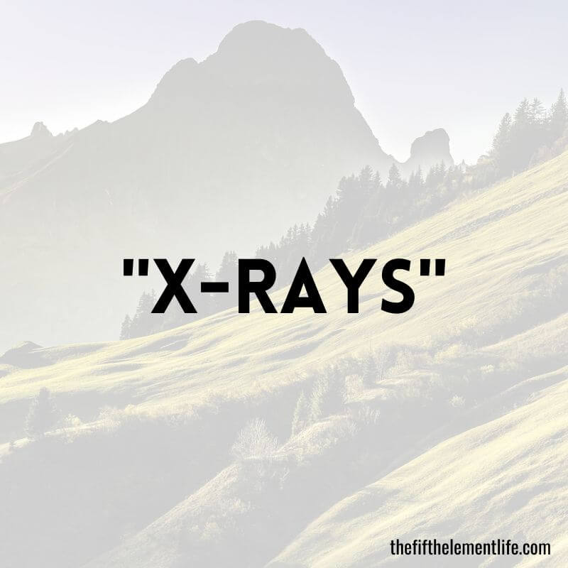 "X-Rays"